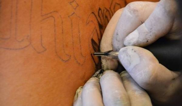 Fjerne tatovering