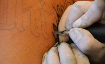 Fjerne tatovering